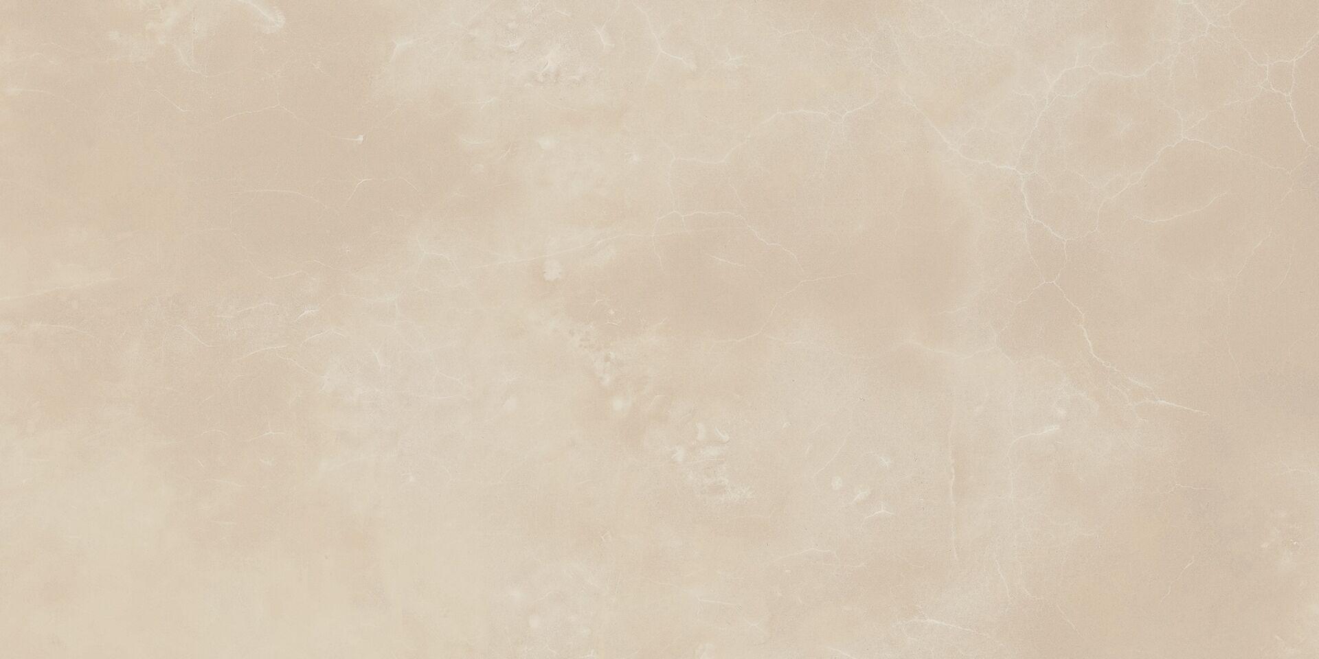 Onyx Lux Rett 44