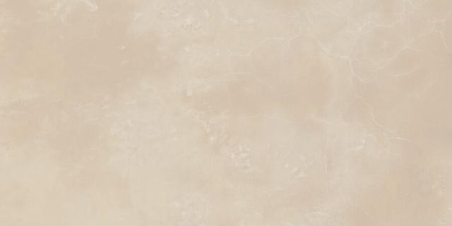 Onyx Lux Rett 44